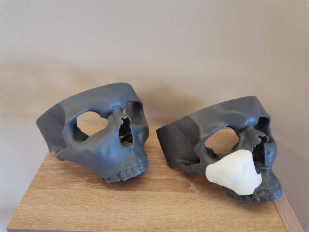 3D Εκτύπωση στη Χειρουργική